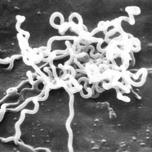 Photo Credit:
Content Providers(s): CDC/ Dr. David Cox / Marked as being in the public domain Go to this species on the OneZoom tree of life